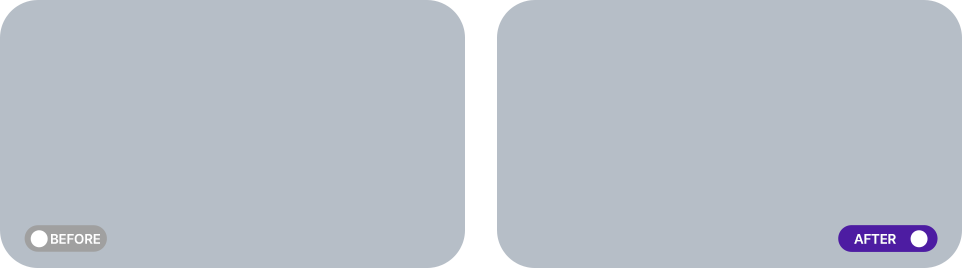 써마지 FLX 전후사진