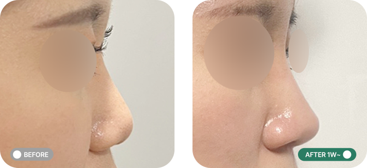 코프팅 전후사진