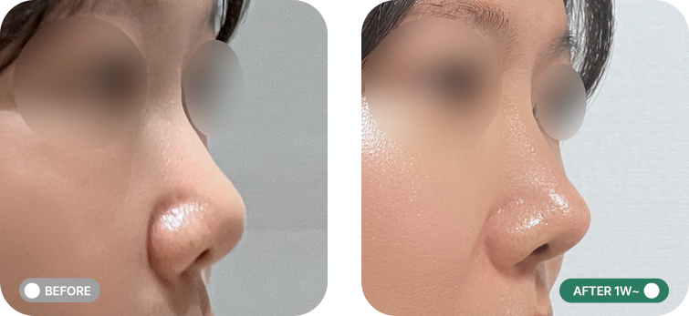 코프팅 전후사진